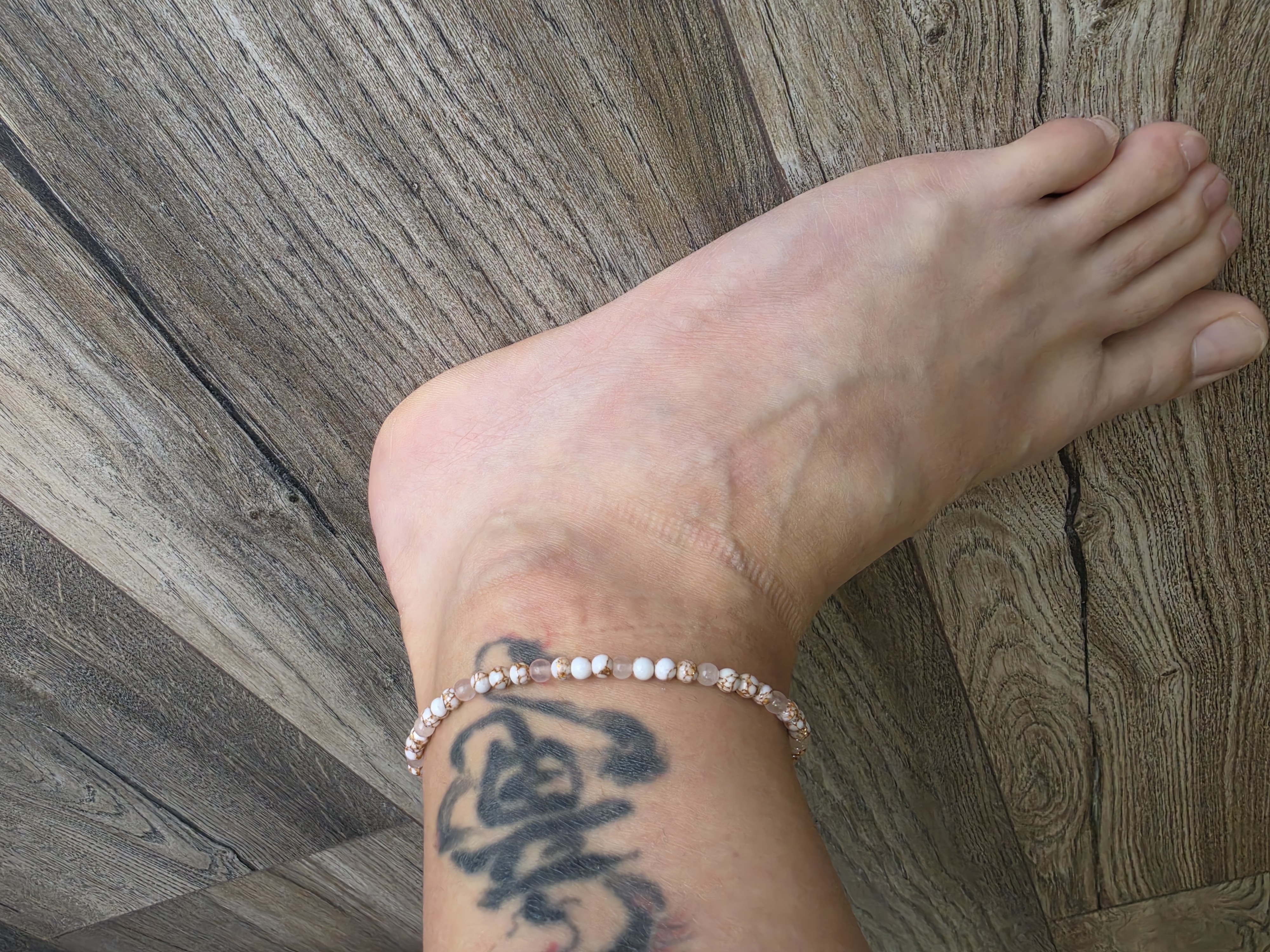 example anklet